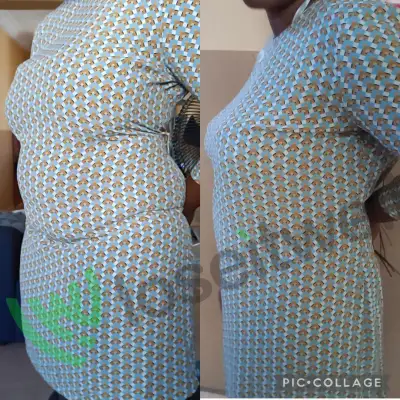 A member's before and after photos, side by side.